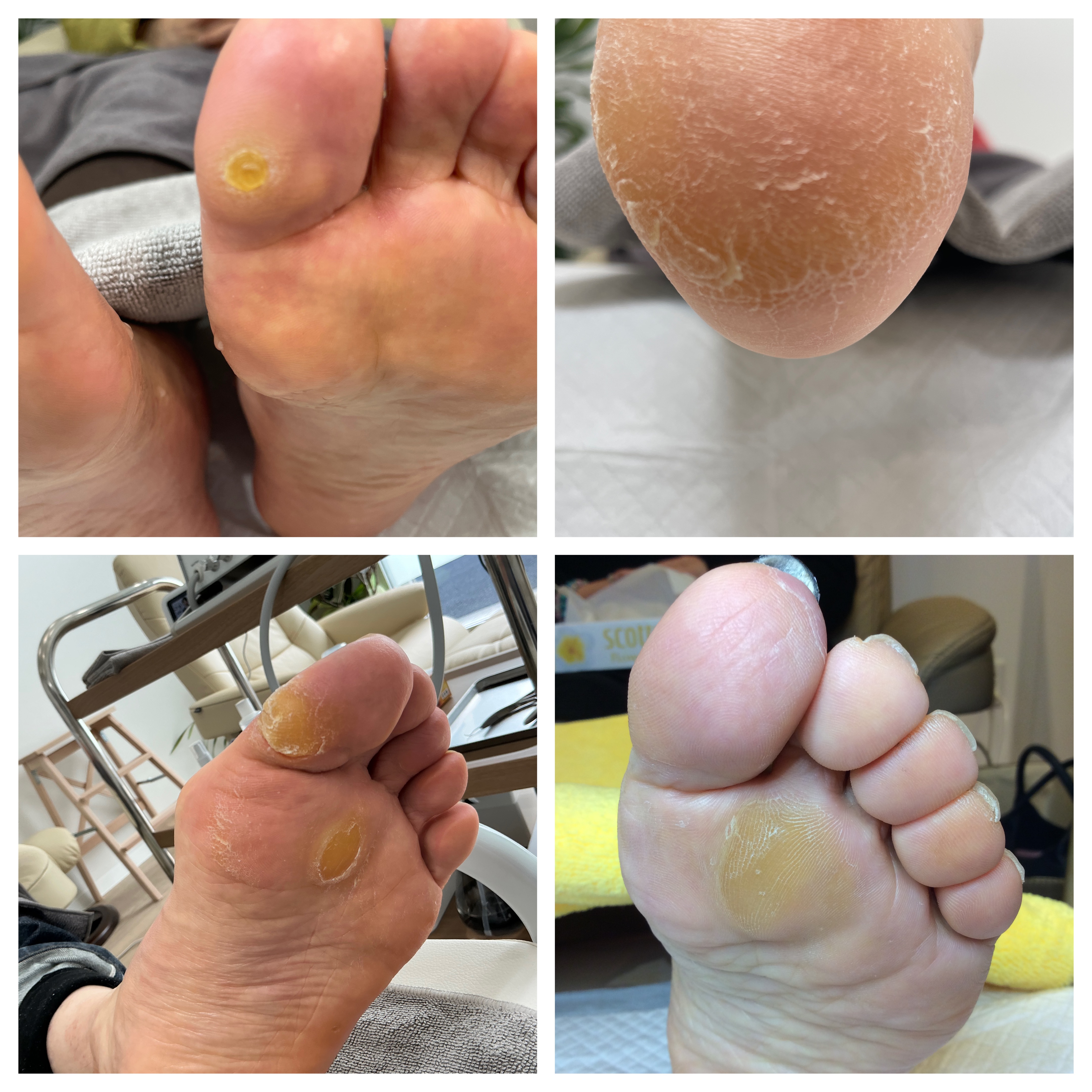 痛みのない優しい施術