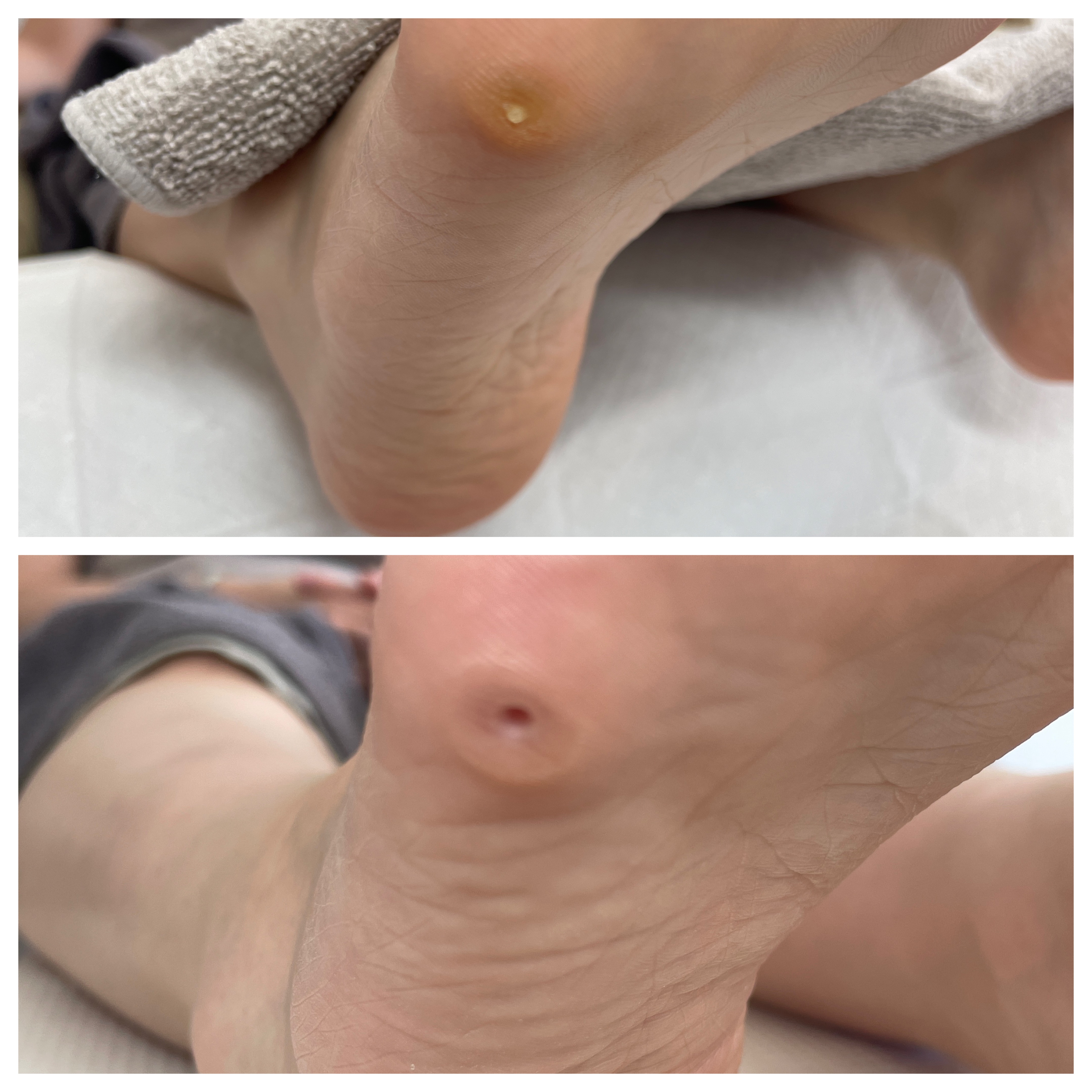 リラックスできる空間での施術